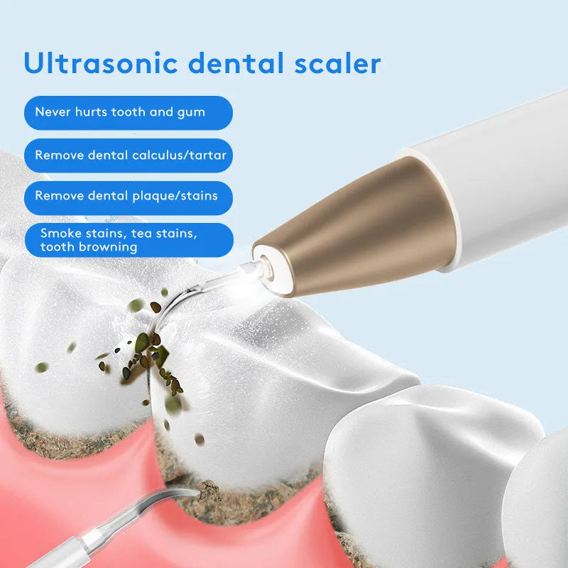 Gold-coloured ultrasonic tooth cleaner for tartar and stain removal at home