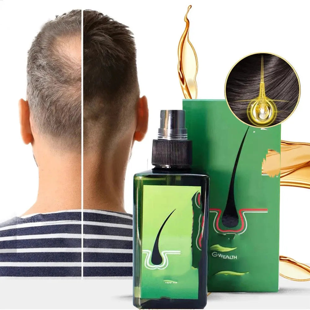 120ml anti-dandruff repair shampoo with free microneedling roller for scalp oil control and anti-itch care