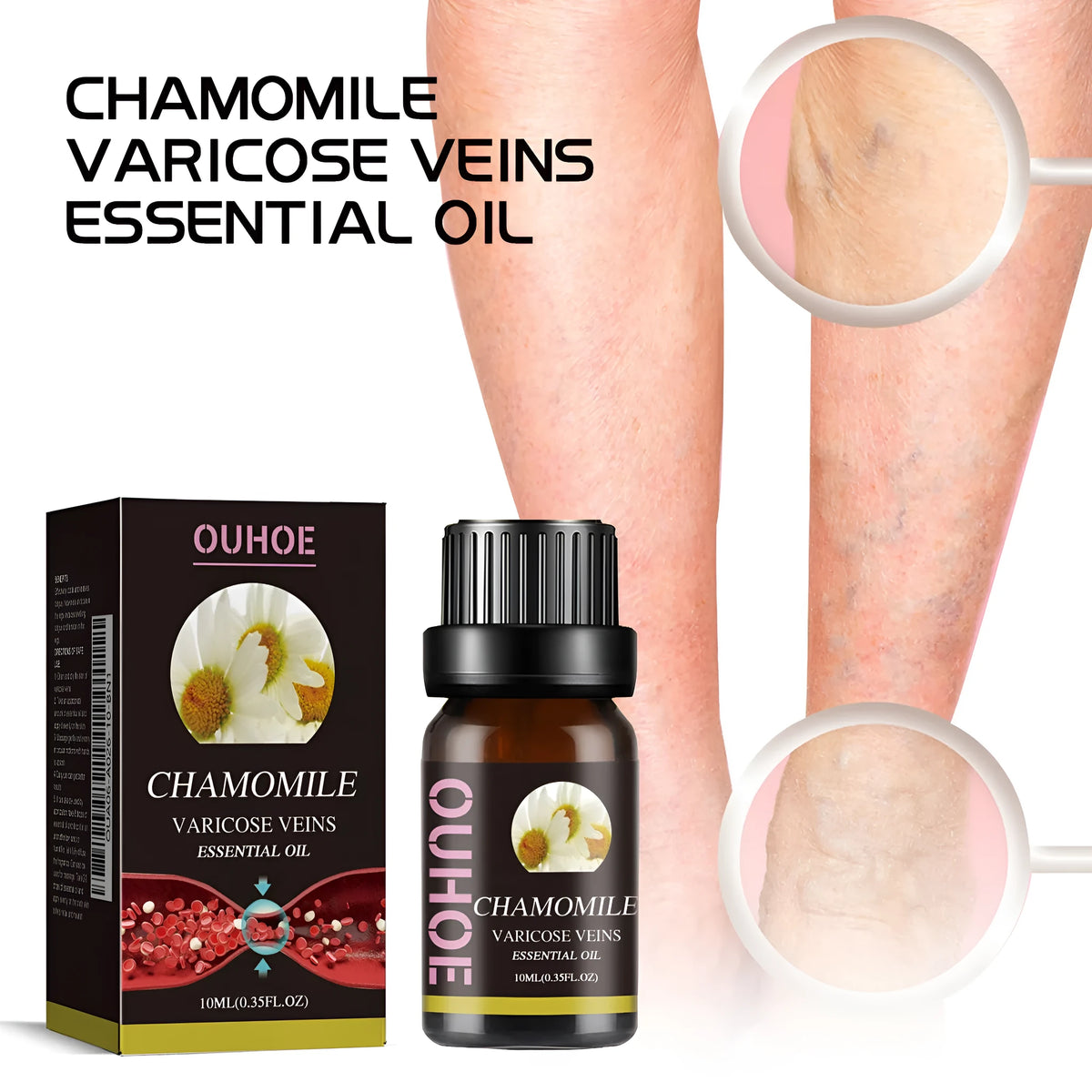 10ml glass bottle of chamomile essential oil for leg skin care and massage.