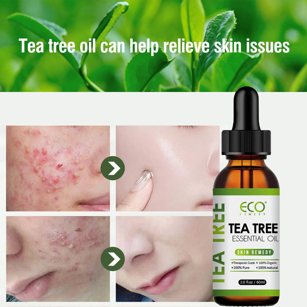 60ml tea tree essential oil roll-on bottle for acne treatment and skincare