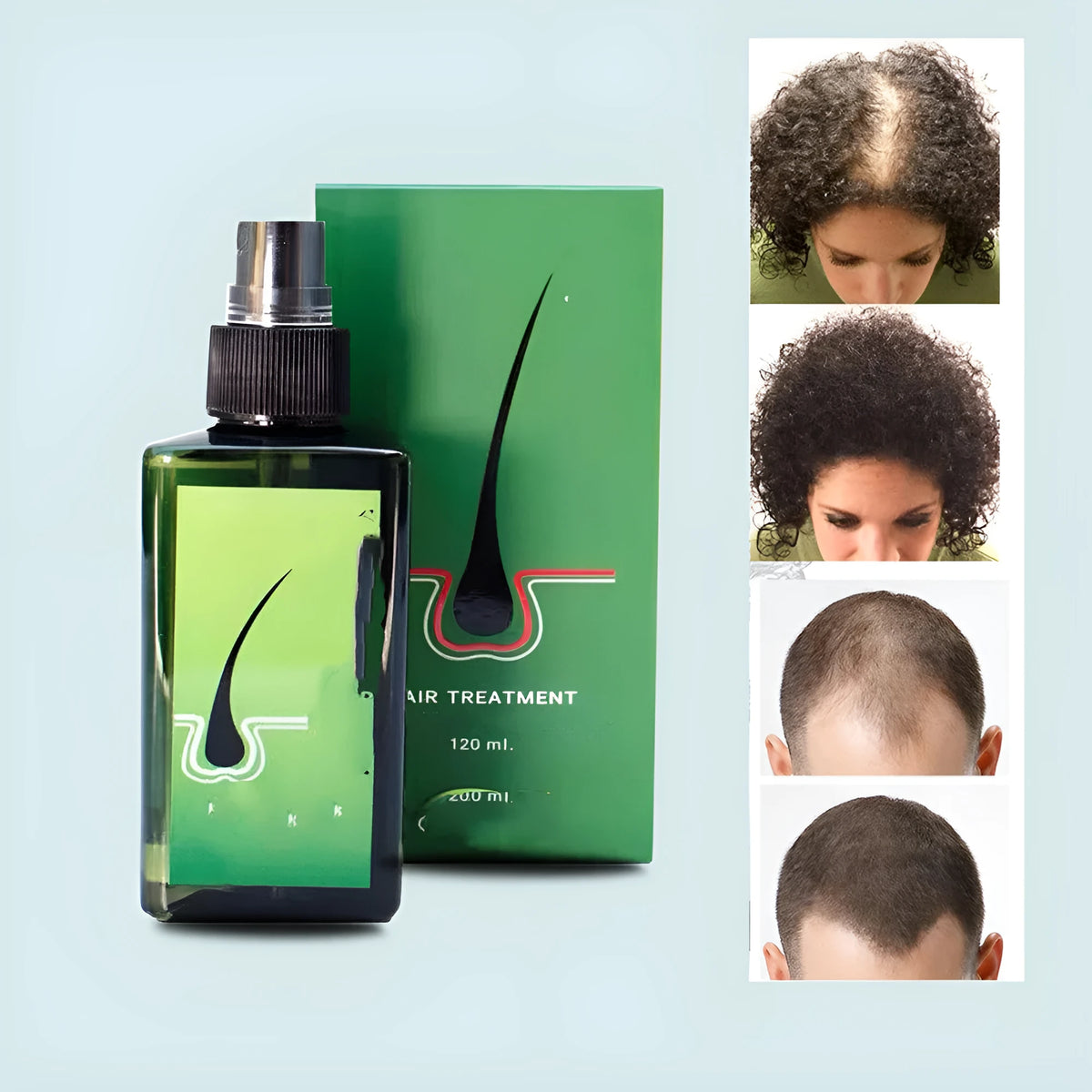 120ml anti-dandruff repair shampoo with free microneedling roller for scalp oil control and anti-itch care