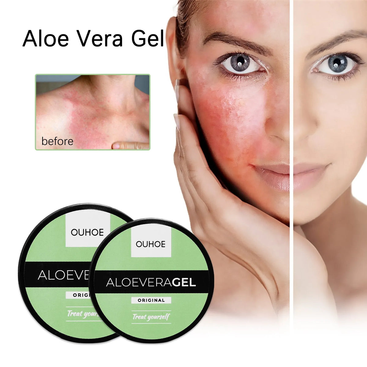 Tanning cream and aloe vera gel set for intensive tanning and after sun skin care repair.