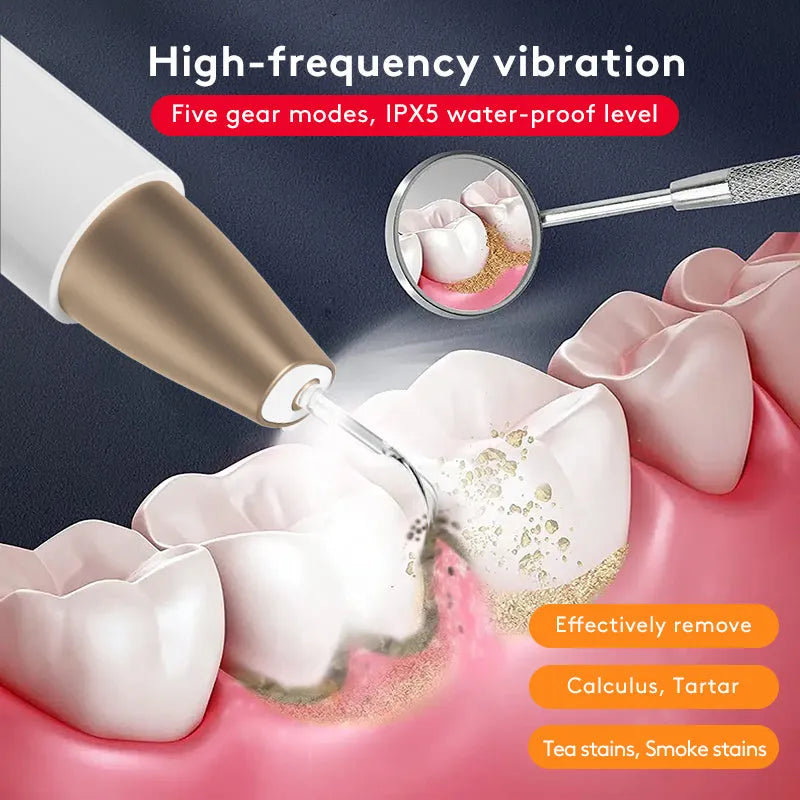 Gold-coloured ultrasonic tooth cleaner for tartar and stain removal at home