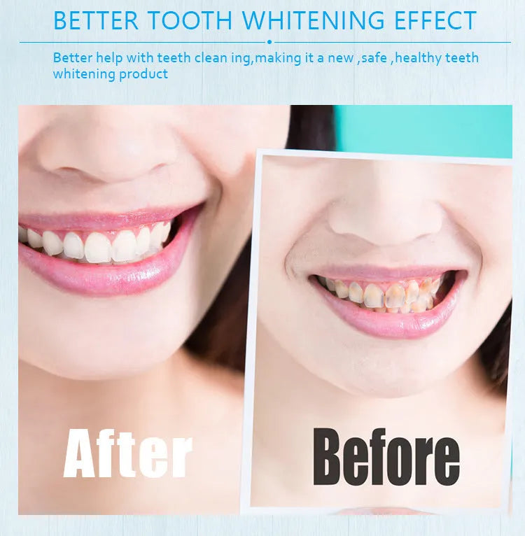 Teeth whitening pen with plastic and aluminium case options in various colours