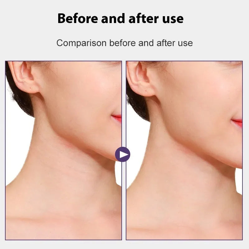 Skin tone neck firming adhesive tape with V27 pattern sling and twenty patches