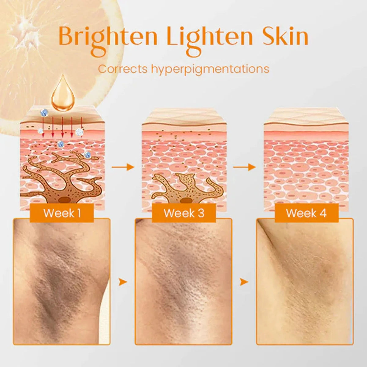 100g whitening vitamin soap bar for body care with kojic acid and hyaluronic acid