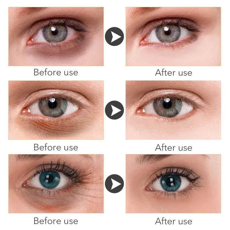 30ml eye cream in packaging for women's skincare routine