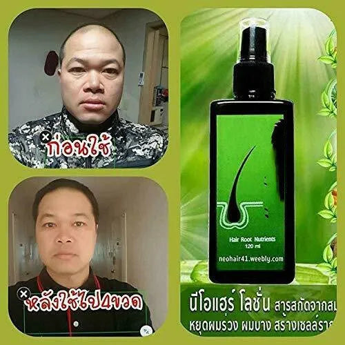 120ml anti-dandruff repair shampoo with free microneedling roller for scalp oil control and anti-itch care
