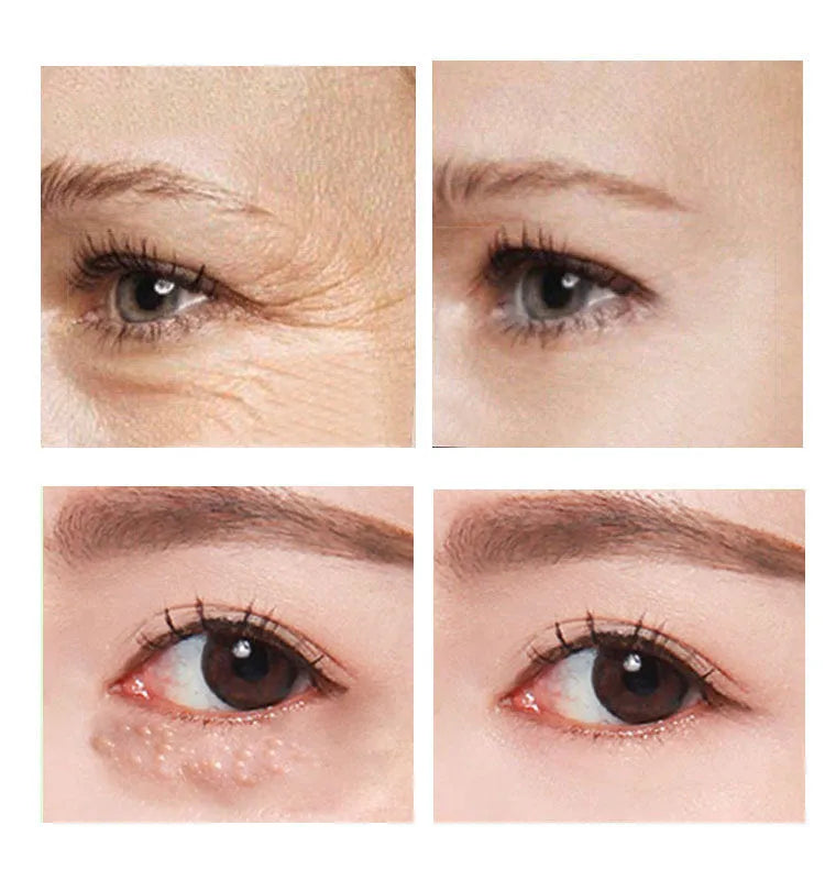 30ml eye cream in packaging for women's skincare routine