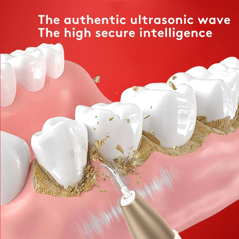 Gold-coloured ultrasonic tooth cleaner for tartar and stain removal at home